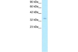WB Suggested Anti-ZNF391 Antibody Titration:  0. (ZNF391 anticorps  (N-Term))