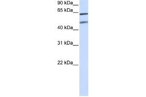 WB Suggested Anti-OPTN Antibody Titration:  0. (OPTN anticorps  (N-Term))