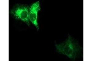 Immunofluorescence (IF) image for anti-ADAM Metallopeptidase with thrombospondin Type 1 Motif, 8 (ADAMTS8) antibody (ABIN1496471) (ADAMTS8 anticorps)
