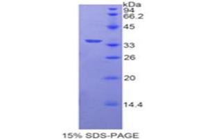 SDS-PAGE (SDS) image for Carboxypeptidase B2 (Plasma) (CPB2) (AA 138-386) protein (His tag) (ABIN1877635)