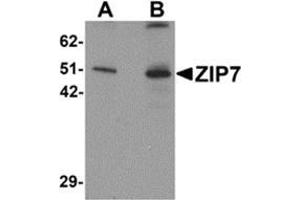 Western blot analysis of ZIP7 in mouse brain tissue lysate with ZIP7 antibody at (A) 0. (SLC39A7 anticorps  (N-Term))