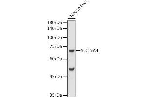 Western blot analysis of extracts of Mouse liver, using F/SLC27 antibody (ABIN7270444) at 1:1000 dilution. (SLC27A4 anticorps  (AA 574-643))