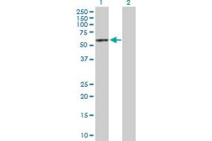 Western Blot analysis of PDK4 expression in transfected 293T cell line by PDK4 MaxPab polyclonal antibody. (PDK4 anticorps  (AA 1-411))