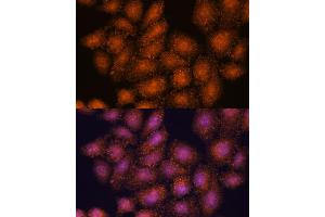 Immunofluorescence analysis of HeLa cells using SMYD3 antibody (ABIN7270260) at dilution of 1:100. (SMYD3 anticorps  (AA 50-150))