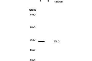 L1 rat kidney lysate L2 rat brain lysates probed with Anti Nucleophosmin Polyclonal Antibody, Unconjugated (ABIN1387533) at 1:200 overnight at 4 °C.