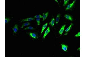 Immunofluorescent analysis of Hela cells using ABIN7173261 at dilution of 1:100 and Alexa Fluor 488-congugated AffiniPure Goat Anti-Rabbit IgG(H+L)