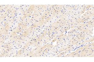 Detection of CHRNb2 in Human Cardiac Muscle Tissue using Polyclonal Antibody to Cholinergic Receptor, Nicotinic, Beta 2 (CHRNb2)