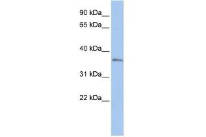 WB Suggested Anti-SIX3 Antibody Titration:  0.