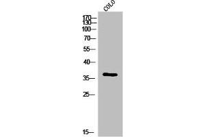 Western Blot analysis of colo cells using IgG1 Polyclonal Antibody