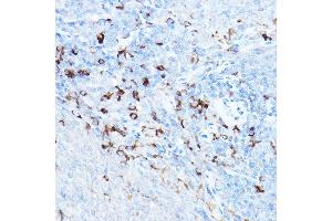 Immunohistochemistry of paraffin-embedded rat spleen using cI Rabbit pAb (ABIN1678920, ABIN3015349, ABIN3015350 and ABIN6213998) at dilution of 1:25 (40x lens).