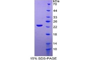 SDS-PAGE of Protein Standard from the Kit (Highly purified E.