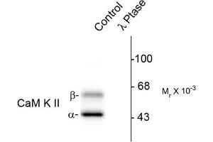 Image no. 1 for anti-Calcium/calmodulin-Dependent Protein Kinase II alpha (CAMK2A) (pThr286) antibody (ABIN372889)