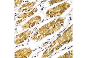 Immunohistochemistry of paraffin-embedded Human gastric using ABO antibody at dilution of 1:100 (x400 lens). (ABO anticorps  (AA 54-354))