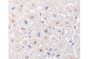 Immunohistochemistry of DcR3 in human heart tissue with DcR3 antibody at 1 μg/ml.