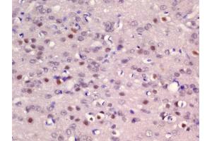Formalin-fixed and paraffin embedded rat brain labeled with Rabbit Anti-ER81 Polyclonal Antibody, Unconjugated (ABIN1385970) at 1:200 followed by conjugation to the secondary antibody and DAB staining (ETV1 anticorps  (AA 21-120))