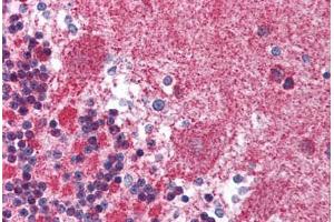 Human Brain, Cerebellum (formalin-fixed, paraffin-embedded) stained with KIF23 antibody ABIN214121 at 5 ug/ml followed by biotinylated goat anti-rabbit IgG secondary antibody ABIN481713, alkaline phosphatase-streptavidin and chromogen.