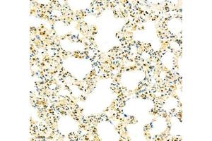 Immunohistochemistry of paraffin embedded rat lung using tfiib (ABIN7074034) at dilution of 1: 900 (250x lens) (GTF2B anticorps)
