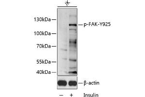 Western blot analysis of extracts of Jurkat cell line, using Phospho-FAK-Y925 antibody (ABIN6135297, ABIN6136216, ABIN6136217 and ABIN6225615) 1:1000 dilution. (FAK anticorps  (pTyr925))