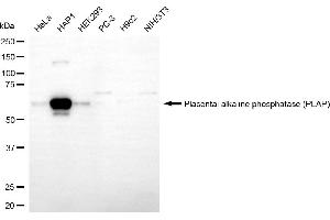 Western blotting analysis using placental alkaline phosphatase (PLAP) antibody (ABIN7799844).
