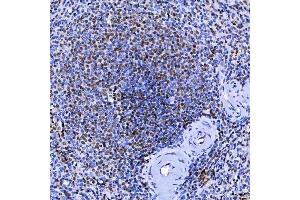 IHC analysis of SF3A1 using anti-SF3A1 antibody (ABIN7600556). (SF3A1 anticorps  (AA 20-556))