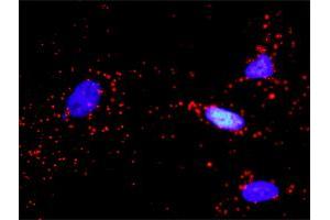 Proximity Ligation Analysis of protein-protein interactions between IGF1R and PIK3R3.