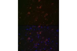 Immunofluorescence analysis of rat brain using Huntingtin Rabbit mAb (ABIN7267793) at dilution of 1:100 (40x lens). (Huntingtin anticorps)