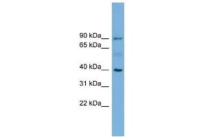 WB Suggested Anti-HFE Antibody Titration:  0. (HFE anticorps  (N-Term))