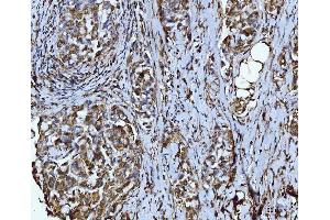 IHC analysis of Integrin linked ILK using anti-Integrin linked ILK antibody (ABIN7602632).