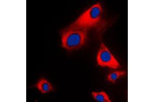 Immunofluorescent analysis of Glycerol Kinase 1 staining in H9C2 cells. (Glycerol Kinase 1 anticorps  (C-Term))