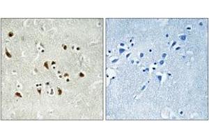 Immunohistochemistry (IHC) image for anti-Tubulin, gamma Complex Associated Protein 6 (TUBGCP6) (AA 741-790) antibody (ABIN2890337) (GCP6 anticorps  (AA 741-790))