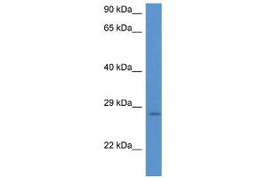 WB Suggested Anti-EIF6 AntibodyTitration: 1. (EIF6 anticorps  (N-Term))