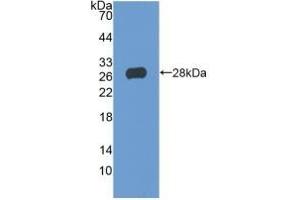 Detection of Recombinant TIGIT, Human using Polyclonal Antibody to T-Cell Immunoreceptor With Ig And ITIM Domains Protein (TIGIT) (TIGIT anticorps  (AA 21-234))