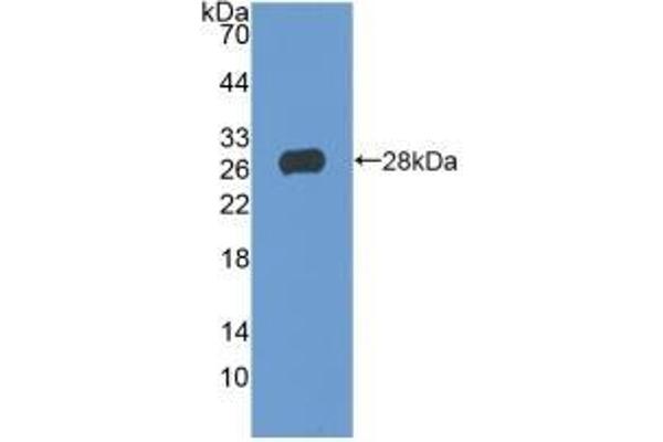 TIGIT anticorps  (AA 21-234)
