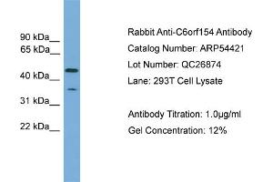 WB Suggested Anti-C6orf154  Antibody Titration: 0. (C6orf154 anticorps  (N-Term))