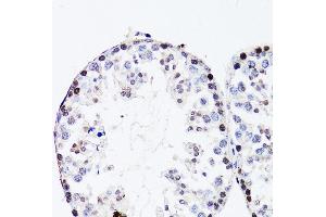 Immunohistochemistry of paraffin-embedded mouse testis using FGF12 antibody (ABIN3016419, ABIN3016420, ABIN1679841 and ABIN6219744) at dilution of 1:150 (40x lens).