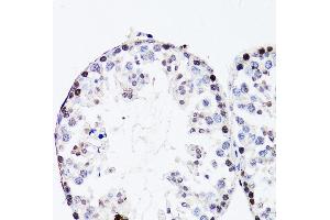 Immunohistochemistry of paraffin-embedded mouse testis using FGF12 antibody (ABIN3016419, ABIN3016420, ABIN1679841 and ABIN6219744) at dilution of 1:150 (40x lens). (FGF12 anticorps  (AA 1-181))