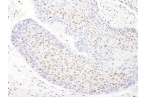 Immunohistochemistry (IHC) image for anti-TAR DNA Binding Protein (TARDBP) (AA 150-200) antibody (ABIN7454905)