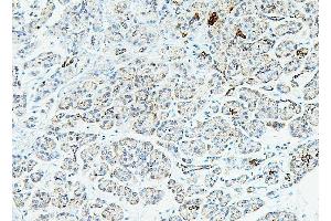 IHC analysis of RPL13A using anti-RPL13A antibody (ABIN7600470).
