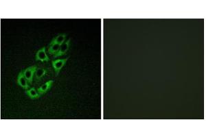 Immunofluorescence analysis of A549 cells, using MtSSB antibody. (SSBP1 anticorps  (C-Term))