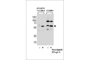 Western blot analysis of lysate from Hela cells(from left to right),untreated or treated with Nocodazole at 50 ng/mL,using Phospho-CCNB1-S35 Antibody (ABIN1881155 and ABIN2839973) or CCNB1-S9 Antibody.