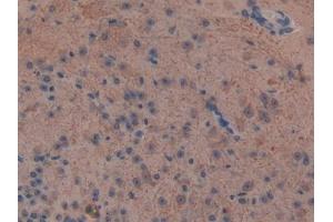 anti-Neurofilament, Light Polypeptide (NEFL) (AA 139-234) antibody