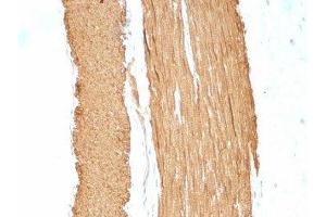 Formalin-fixed, paraffin-embedded rat stomach stained with ACTA2 antibody.