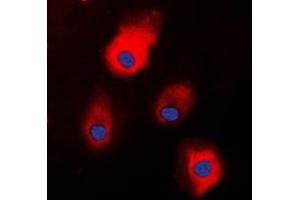Immunofluorescent analysis of S100-A1 staining in HEK293T cells. (S100A1 anticorps  (N-Term))