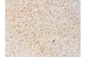 ABIN7094722 and ABIN7098773 at 1/100 staining Rat brain tissue by IHC-P.