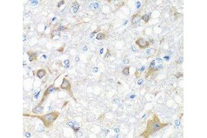 Immunohistochemistry of paraffin-embedded Rat brain using IL22 Polyclonal Antibody at dilution of 1:100 (40x lens). (IL-22 anticorps)
