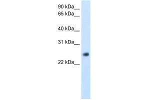 WB Suggested Anti-GGTLA4 Antibody Titration:  5.