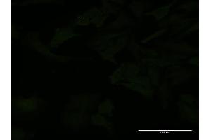 Immunofluorescence of monoclonal antibody to CCS on HeLa cell.