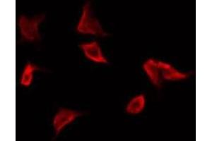 ABIN6269295 staining NIH-3T3 by IF/ICC. (14-3-3 zeta anticorps  (Internal Region))