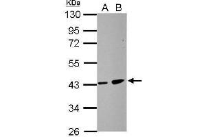 WB Image Sample (30 ug of whole cell lysate) A: HCT116 B: MCF-7 10% SDS PAGE antibody diluted at 1:500 (ZDHHC11 anticorps)