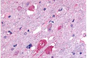 Anti-GALR2 antibody  ABIN1048645 IHC staining of human brain, neurons and glia.